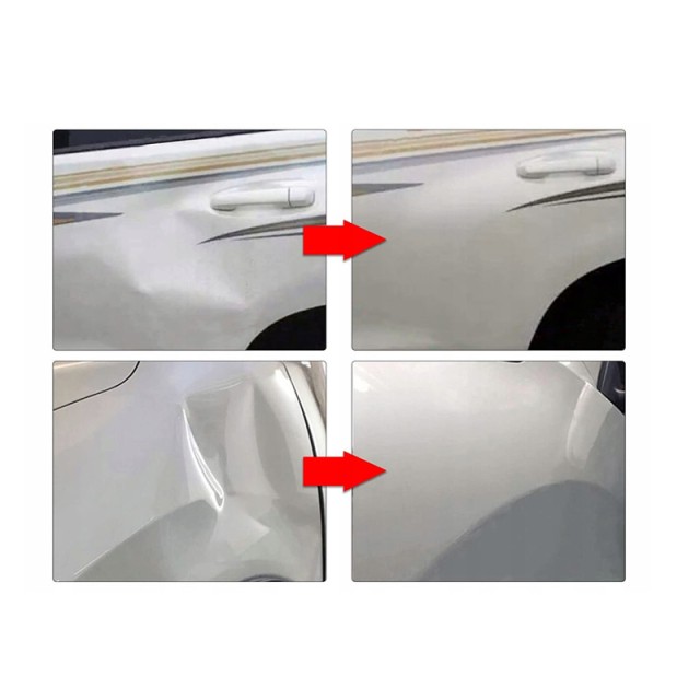 Κιτ Επιδιόρθωσης Βαθουλωμάτων Αυτοκινήτου 20 τμχ Verk Group 5907451...