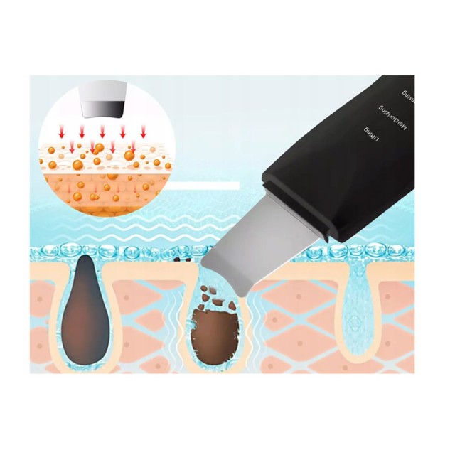 Συσκευή Απολέπισης και Καθαρισμού Προσώπου με Υπερήχους Verk Group ...